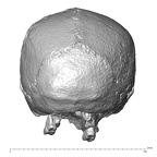 STEINHEIM SMNS-P-17230 SMNS-P-17230 Homo heidelbergensis cranium posterior