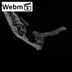 STEINHEIM SMNS-P-17230 Homo heidelbergensis fragment5 webm