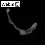 STEINHEIM SMNS-P-17230 Homo heidelbergensis fragment6 webm