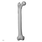 Lower limb