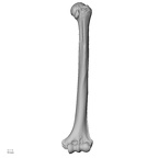 Upper limb