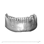 NGA88 SK1030 Homo sapiens mandible dentition anterior