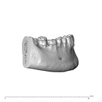 NGA88 SK1030 Homo sapiens mandible dentition lateral left