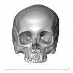 NGA88 SK1053 Homo sapiens cranium anterior