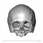 NGA88 SK1067 H. sapiens cranium