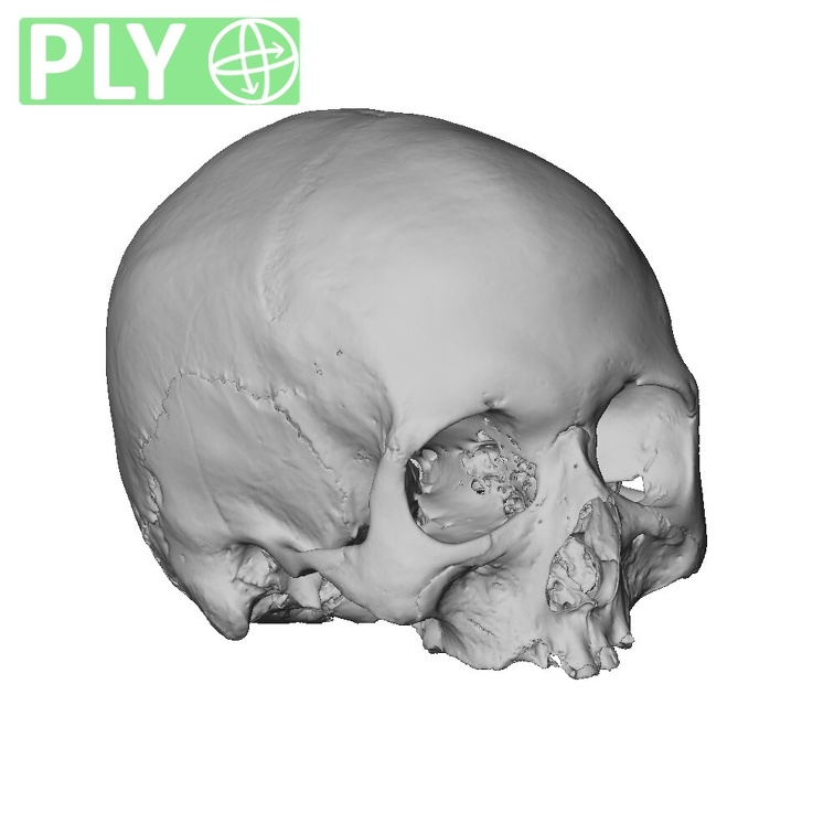NGA88 SK1067 H. sapiens cranium ply