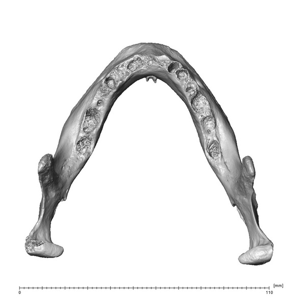NGA88 SK1067 Homo sapiens mandible superior