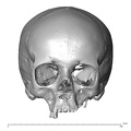 NGA88_SK1130_Homo_sapiens_cranium_anterior.jpg