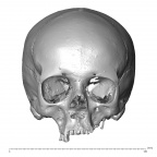 NGA88 SK1130 Homo sapiens cranium anterior