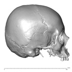 NGA88 SK1130 Homo sapiens cranium lateral