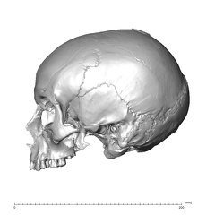 NGA88 SK1212 Homo sapiens cranium lateral left