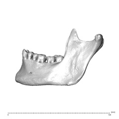 NGA88 SK1212 Homo sapiens mandible lateral left
