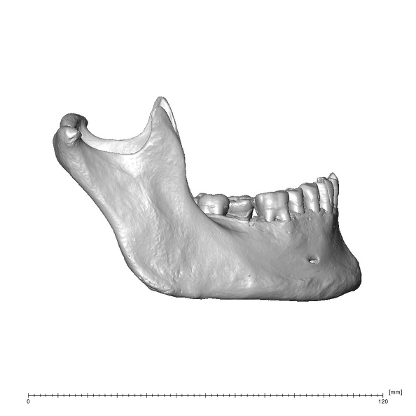 NGA88 SK1212 Homo sapiens mandible lateral right