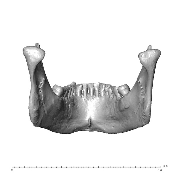 NGA88 SK1212 Homo sapiens mandible posterior
