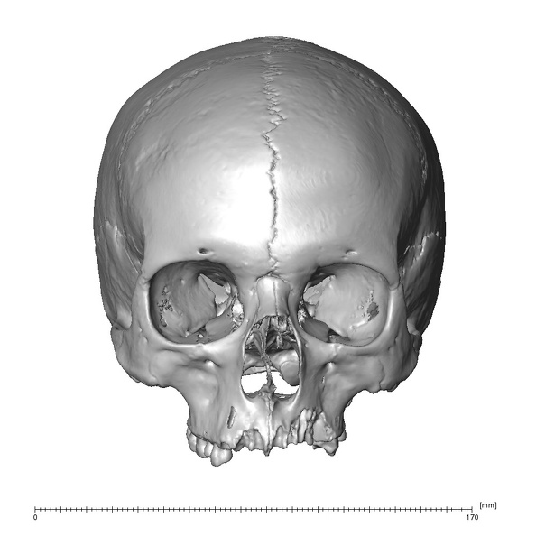 NGA88 SK1218 Homo sapiens cranium anterior