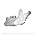 NGA88 SK1218 Homo sapiens mandible lateral left