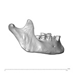 NGA88 SK1218 Homo sapiens mandible lateral right