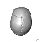 NGA88 SK1222 Homo sapiens cranium superior