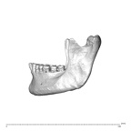 NGA88 SK1222 Homo sapiens mandible lateral left