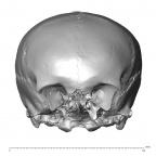 NGA88 SK170 Homo sapiens cranium anterior