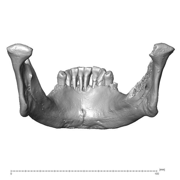 NGA88 SK170 Homo sapiens mandible posterior