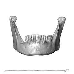 NGA88 SK227 Homo sapiens mandible anterior