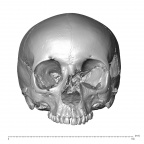 NGA88 SK229 Homo sapiens cranium anterior
