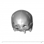 NGA88 SK287 Homo sapiens cranium anterior