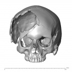 NGA88 SK319 Homo sapiens cranium anterior