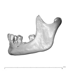 NGA88 SK319 Homo sapiens mandible lateral left