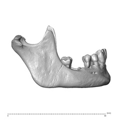 NGA88 SK319 Homo sapiens mandible lateral right