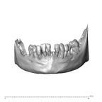 NGA88 SK319 Homo sapiens mandible dentition anterior