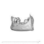 NGA88 SK319 Homo sapiens mandible dentition lateral right