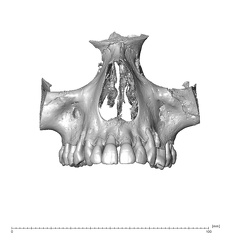 NGA88 SK319 Homo sapiens maxilla anterior