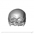 NGA88 SK341 H. sapiens cranium