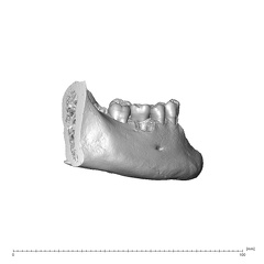 NGA88 SK376 Homo sapiens mandible dentition lateral left
