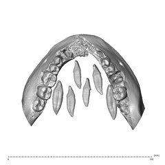 NGA88 SK376 Homo sapiens mandible dentition superior