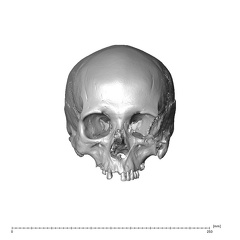 NGA88 SK444 Homo sapiens cranium anterior