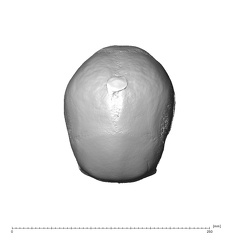 NGA88 SK444 Homo sapiens cranium superior