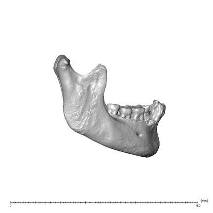 NGA88 SK444 Homo sapiens mandible lateral right