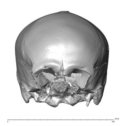 NGA88 SK48 Homo sapiens cranium anterior