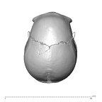 NGA88 SK563 Homo sapien cranium superior