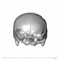 NGA88 SK578 Homo sapiens cranium anterior