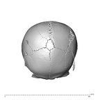 NGA88 SK578 Homo sapiens cranium superior