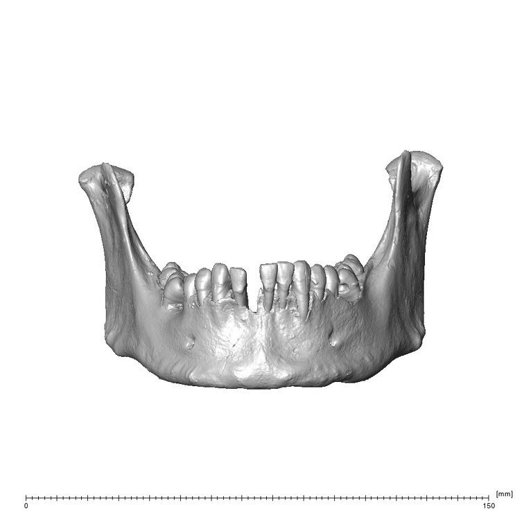 NGA88 SK578 Homo sapiens mandible anterior