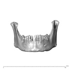 NGA88 SK578 Homo sapiens mandible anterior