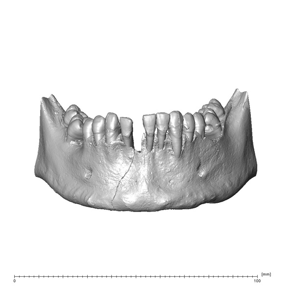 NGA88 SK578 Homo sapiens mandible highres anterior