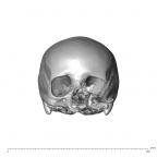 NGA88 SK593 Homo sapiens cranium anterior