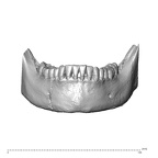 NGA88 SK657 Homo sapiens mandible dentition anterior
