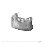 NGA88 SK657 Homo sapiens mandible dentition lateral right
